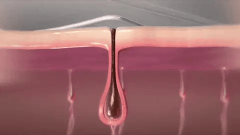 Depiladora Láser Sin Dolor