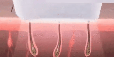 Afeitadora Eléctrica Femenina